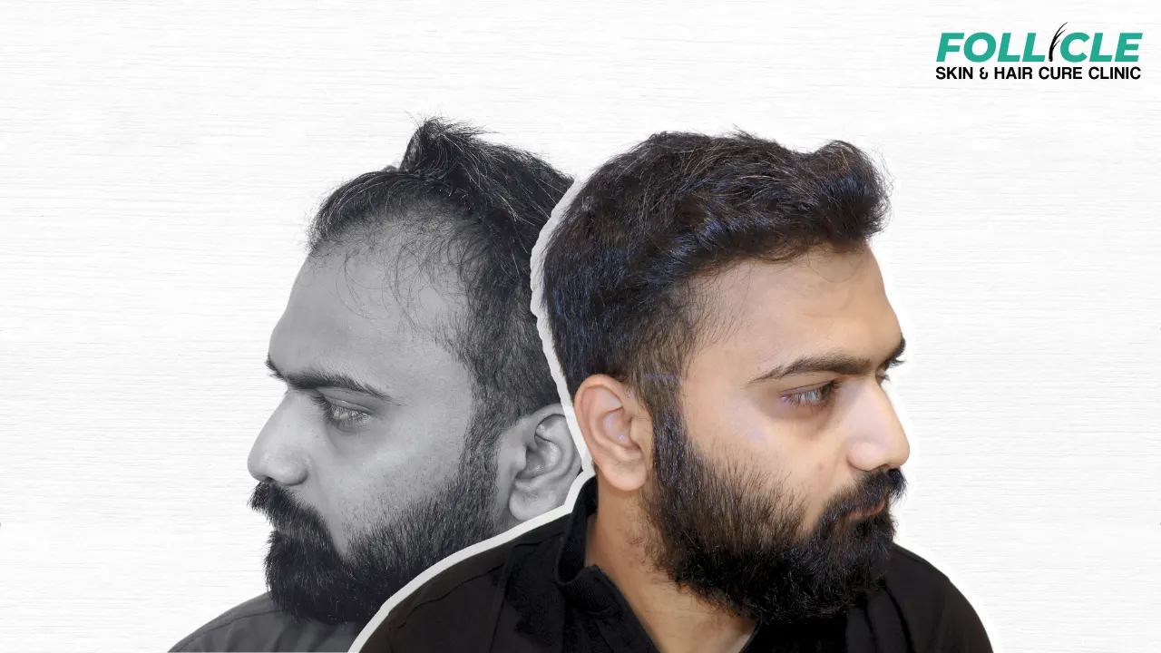 Aniket shinde (Front Profile)