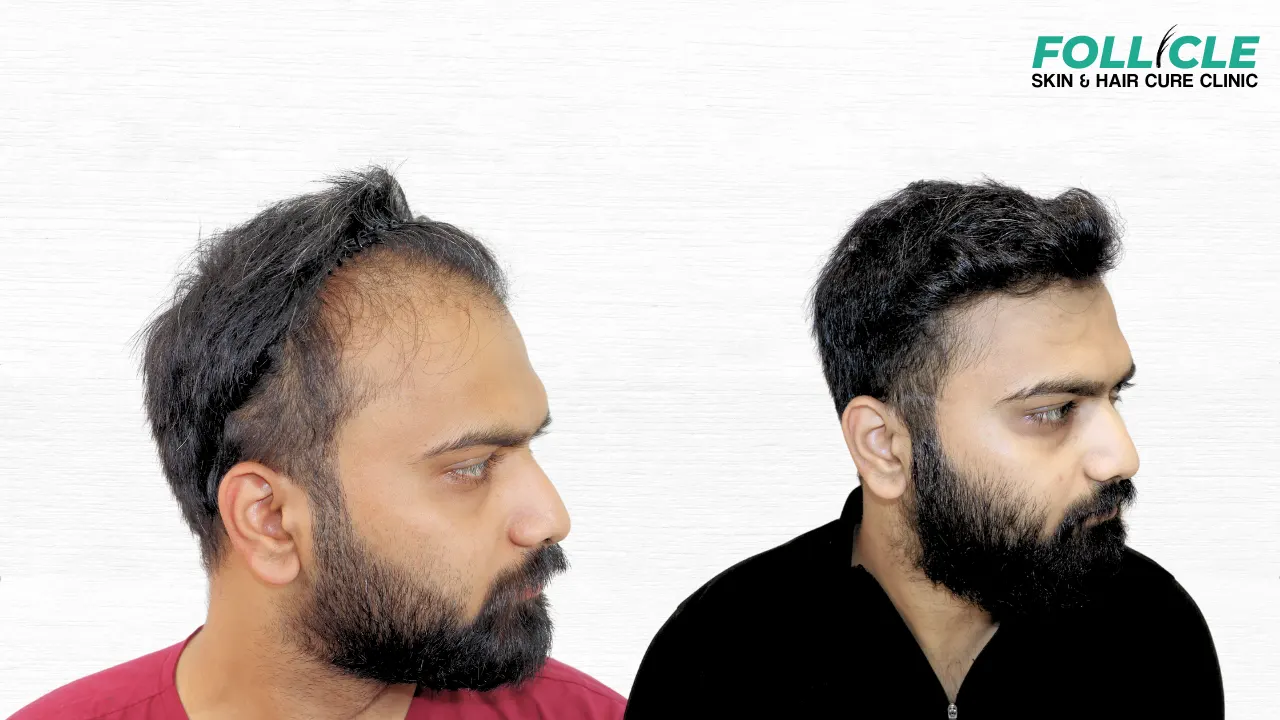 Aniket shinde (Right Profile)