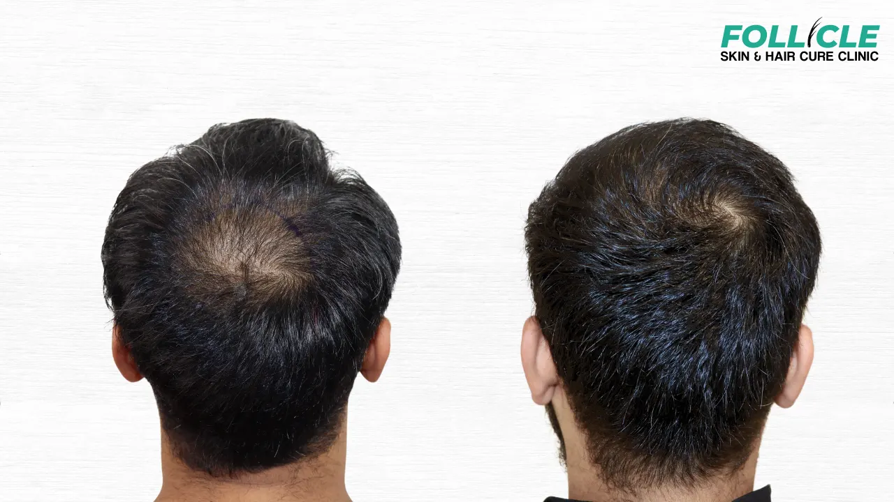 Aniket shinde Right Profile)