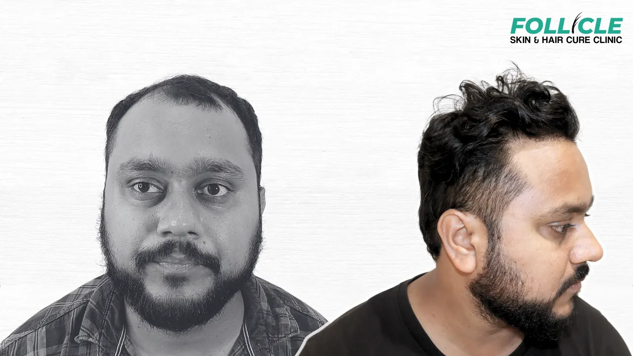 Namit Kumar (Front Profile)