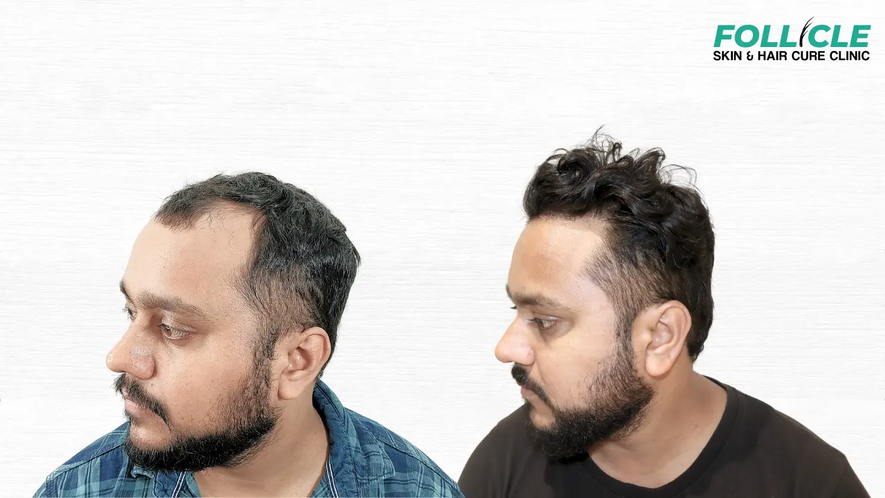 Namit Kumar (Right Profile) (2)