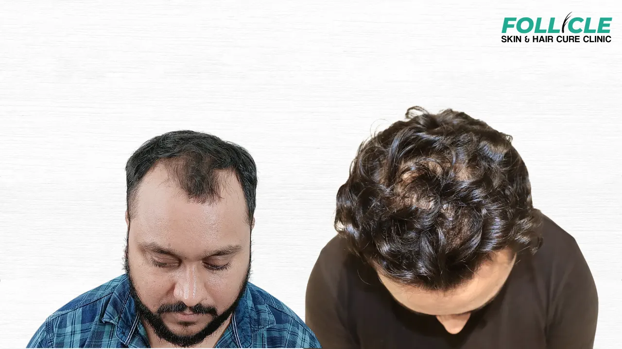 Namit Kumar (Right Profile)