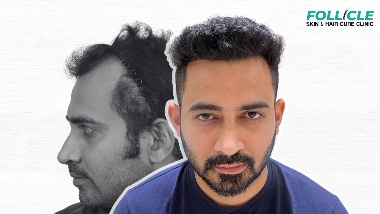 Sachin waykar (Front Profile)