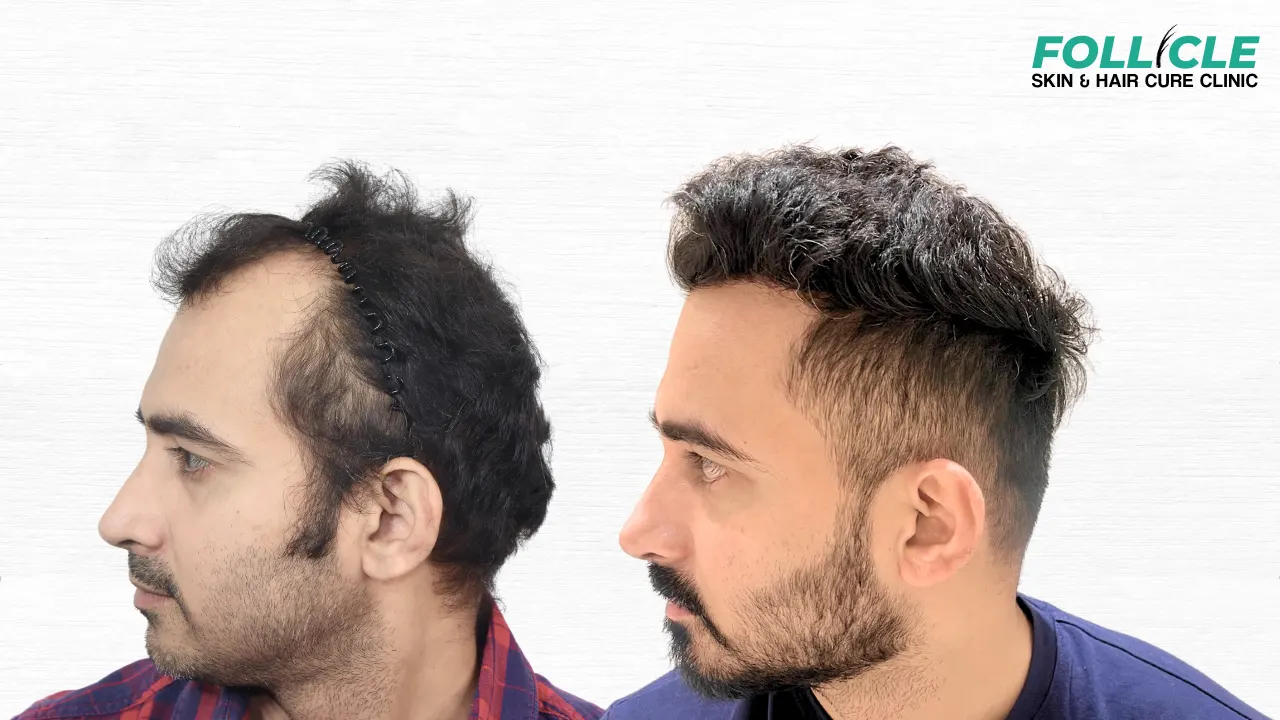 Sachin waykar (Right Profile) (2)