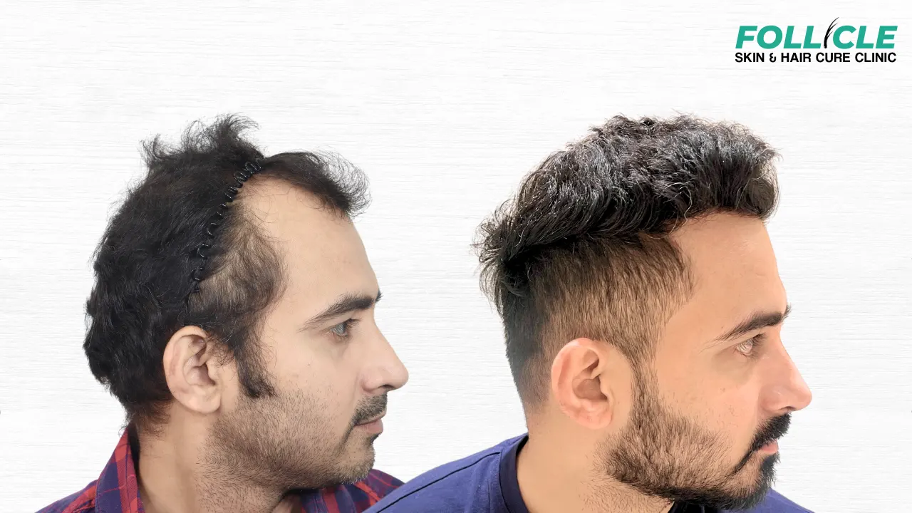 Sachin waykar (Right Profile)