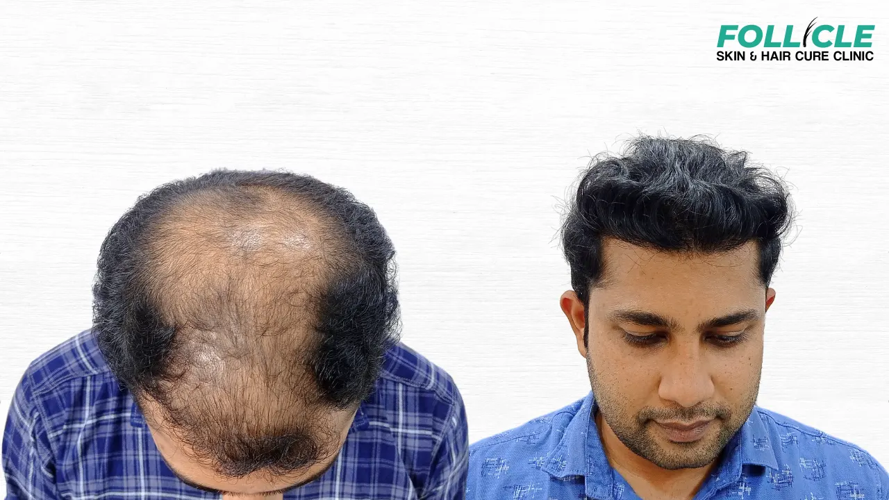 Shaneer Hanif (Right Profile) (2)