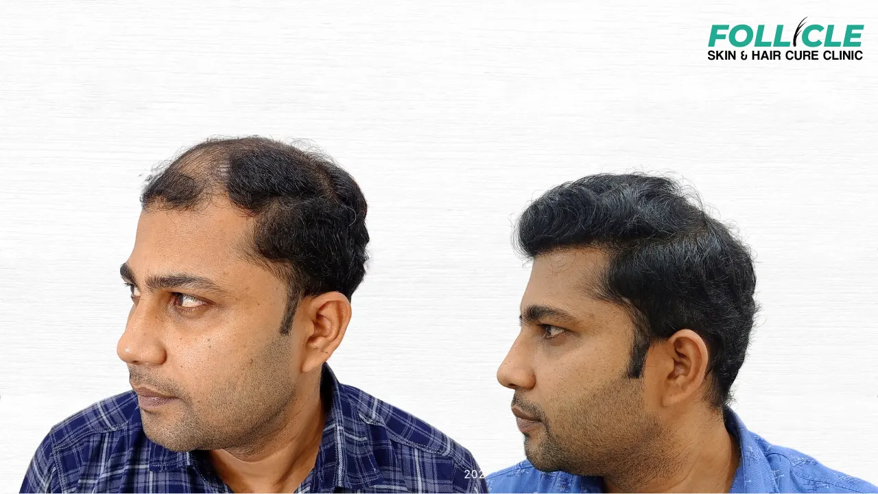 Shaneer Hanif (Right Profile)